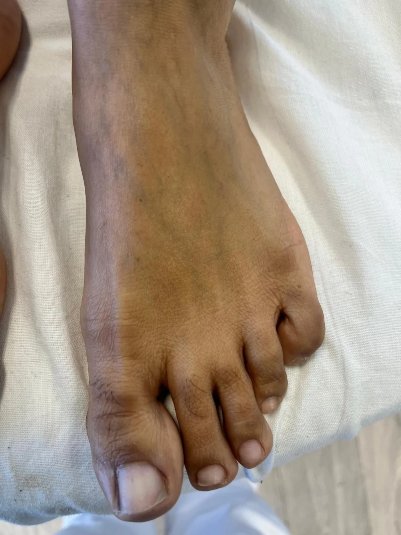 Pedicure 